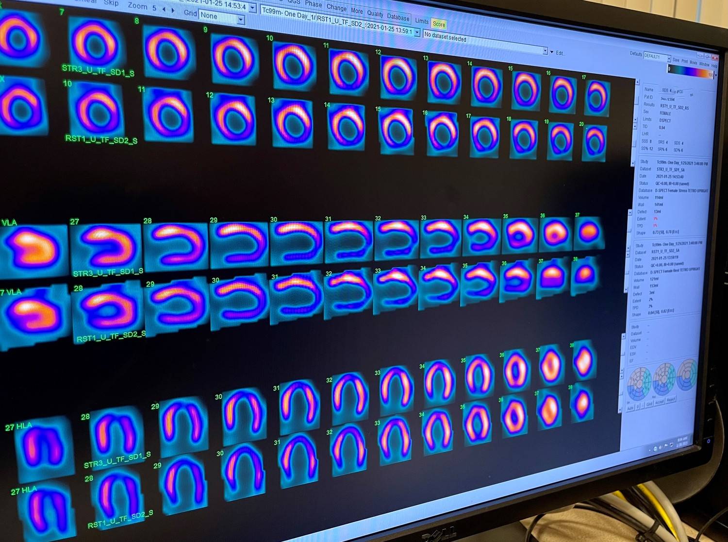 Cardiology Services